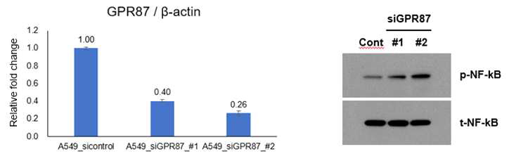 GPR87 발현 억제에 의한 NF-κB 활성화 변화