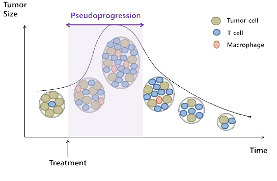 Pseudoprogression의 개요