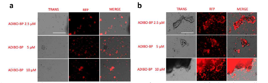 Hydroxyapatite salt (HA) binding of ADIBO-BP modified Jurkat cells. Jurkat cells were first incubated with (a) DMSO (0.1%) or (b) Ac4ManNAz (50 μM) in complete media for 3 days, and then reacted with various concentration of ADIBO-BP for 1.5 h. Thereafter the BP functionalized cells were incubated with HA salts for 30 min, and imaged under fluorescence microscope (magnification: 20X, scale bar: 200 μm). Clusters of aggregated cells on HA salts were only seen with the group treated with Ac4ManNAz and ADIBO-BP