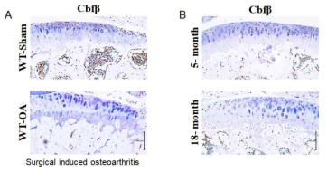 골관절염 및 Aging에 따른 Cbfb의 발현변화