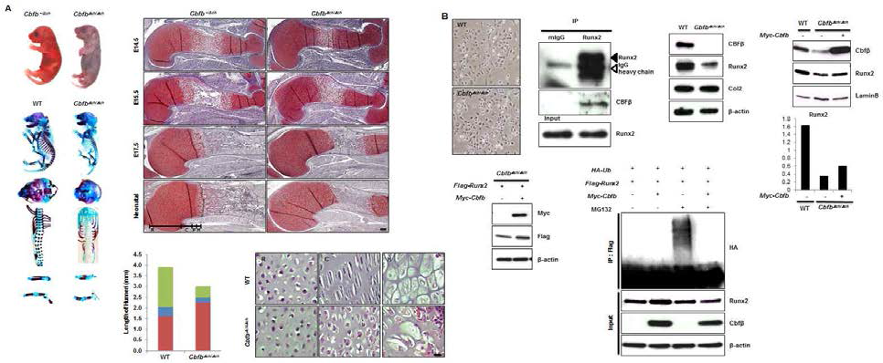 Cbfβ는 Runx2를 조절하여 연골내 골화와 뼈 두께 조절