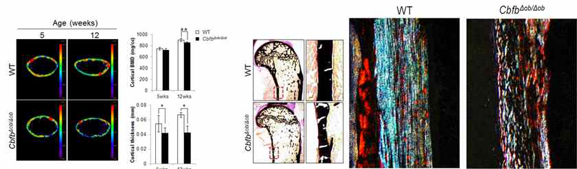 조골세포 특이적으로 Cbfβ 제거 후 피질골 두께 및 뼈 광화 감소 뼈에서 Cbfβ는 Runx2 안전성을 조절하여 막골 두께를 결정하는 중요한 인자임