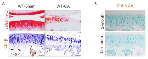 골관절염 모델과 노화된 관절연골에서 Cbfβ의 발현 변화 DMM 골관절염 모델(A)과 노화된 관절연골(B)에서 모두 Cbfβ의 발현 감소됨