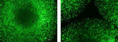 연구실에서 시험관 내 Alginate hydrogel을 이용한 3-D 관절연골세포 배양