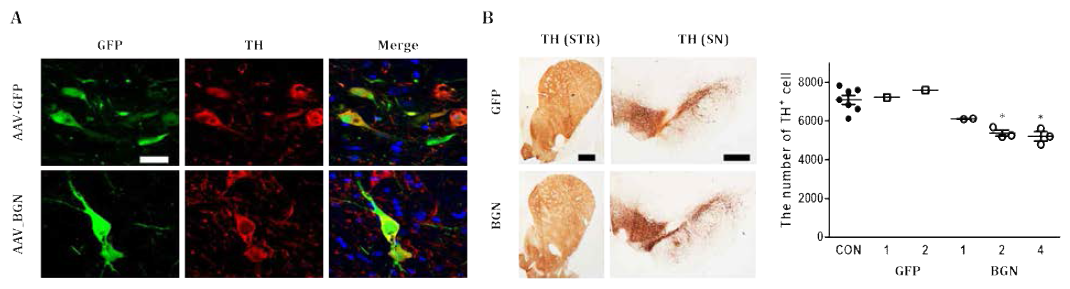 Rat 중뇌 흑질에 AAV-GFP 혹은 AAV-BGN-GFP를 투입한 3주 후 GFP 발현과 도파민신경세포(anti-TH) 면역조직염색