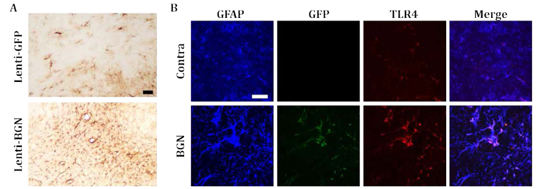 Rat 중뇌 흑질에 Lenti-BGN-GFP를 투입한 후 3주 후 면역조직염색을 통한 성상교세포(GFAP) 활성화(A)와 성상교세포 내 TLR4 수용체 과발현(B)