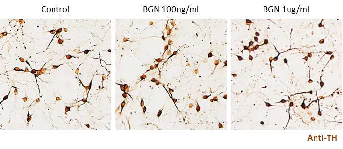 초대배양한 rat 중뇌 신경세포에 재조합 biglycan을 처리한 후 도파민신경세포(anti-TH) 세포면역화학염색