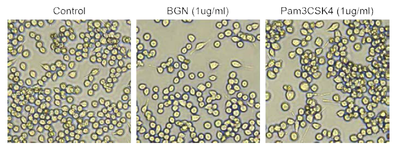 Retinoic Acid에 의해 분화된 인간 도파민 신경세포에 재조합 biglycan 및 TLR2 수용체 활성제인 Pam3CSK4를 처리한 후 위상차 사진을 통한 세포사멸여부 확인