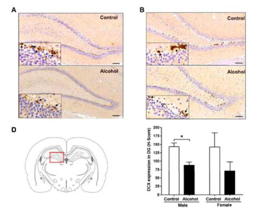 성별에 따른 해마에서의 DCX 발현