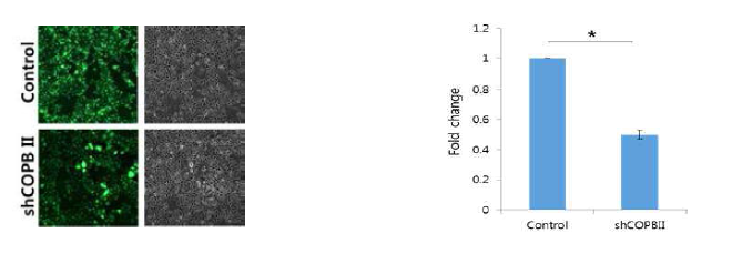 COPBII 발현 조절 구강암 세포주 구축 함