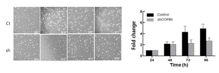 COPBII 발현의 감소는 구강암 세포주의 증식능의 감소를 나타냄
