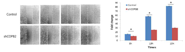 COPBII 발현의 감소는 구강암 세포주의 이동능의 감소를 나타냄
