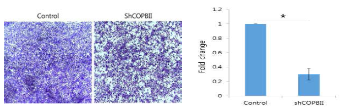 COPBII 발현의 감소는 구강암 세포주의 침윤능의 감소를 나타냄