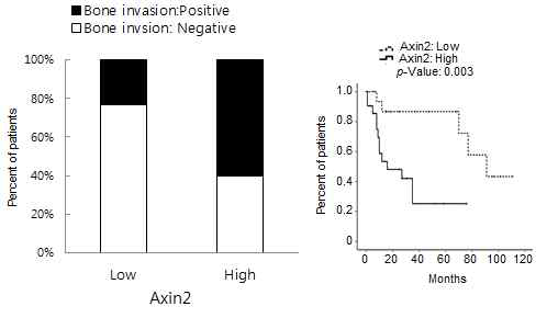 Axin2 발현과 구강암 환자의 뼈 침윤 (좌) 및 생존율(우)과의 상관성 분석
