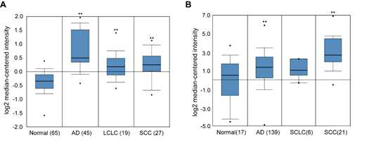 EHMT2 expression in different types of lung cancer (Oncomine database) AD: Lung adenocarcinoma, LCLC: Large cell lung carcinoma, SCC: Squamous cell lung carcinoma