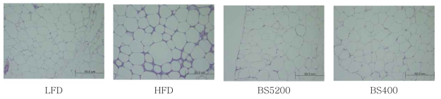 5일차 발아 메밀 in vitro 소화물 경구 투여한 고지방 식이 섭취 실험동물의 부고환지방조직(epididymal white adipose tissue, eWAT) H & E 염색