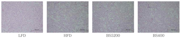 5일차 발아 메밀 in vitro 소화물 경구 투여한 고지방 식이 섭취 실험동물의 갈색지방조직(brown adipose tissue, BAT) H & E 염색