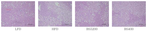 5일차 발아 메밀 in vitro 소화물 경구 투여한 고지방 식이 섭취 실험동물의 간조직 H & E 염색