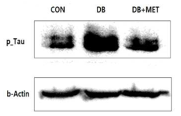 당뇨치료제인 metformin을 처리한 군에서는 PRL 발현 감소 및 Tau 과인산화 감소