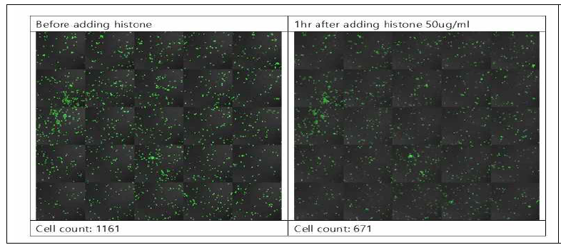 Histone cytotoxicity in synovial fluid macrophage. 류마티스관절염 환자의 synovial fluid에서 얻어진 macrophage에 histone을 처리하고 calcein positive cell을 비교함