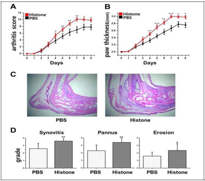 Histone aggravates K/BxN serum-transfer arthritis. K/BxN serum-transfer arthritis was induced by intraperitoneal injection of K/BxN serum on day 0 and 2, and 200 μg of histone or PBS was injected. Arthritis score (A) and paw thickness (B) was assessed. (C) Representative images of H&E stained sections of ankle joints. (D) Histologic scores of synovitis, pannus formation, and erosions of ankle joints