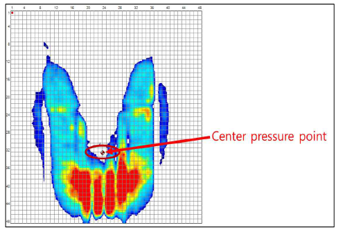 체압 중심점