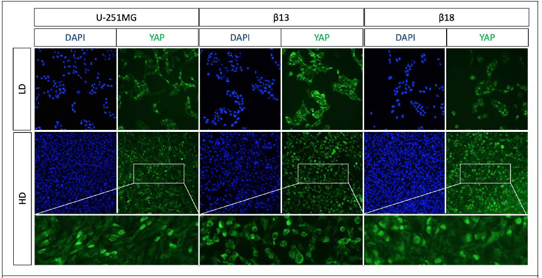 ICC를 통한 YAP ab를 이용한 고농도에서 YAP translocation 패턴 관찰. MuD KD line b18과 함께 wild type U251MG, 그리고 truncated MuD OD b13을 저밀도/고밀도 배양하였음