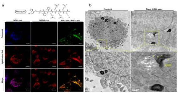 (a, left) Co-localization study of NDI-Lyso with LysoTracker Red FM showing very good localization of NDI-Lyso in lysosome of HeLa cells, (a, middle) assembly of NBD-Lyso (along with its molecular structure) and (a. right) co-assembly of the NDI-Lyso and NBD-lyso in lysosome of HeLa cells using Lysotracker Red. Strong green fluorescence of NBD and its’ high co-localization with LysoTracker Red FM indicates the lysosome induced assembly in HeLa cells. Scale bar corresponds to 10 μm. (b) Cell TEM images of HeLa cells showing the intact lysosome in control cells and existence of small fibers in the lysosome as well as lysosomal damage after 20 hours incubation of NDI-Lyso