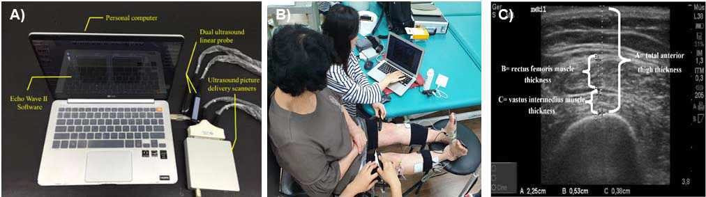 A) dual ultrasound system (Telemed), B) 임상연구측정모습, C) 대퇴직근 영상