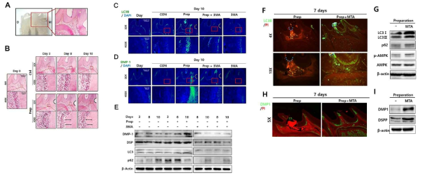 와동모델을 수립하여 자가포식 활성 증가 (LC3B) 및 자가포식 억제제에 의한 분화마커 (DSP, DMP-1) 발현 감소 (C-E) 및 자가포식 활성제에 의한 분화마커 발현 증가 (F-I)
