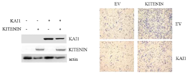 KAI1의 발현에 의한 KITENIN의존적 세포침윤성 억제효과