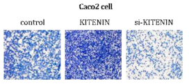 대장암 세포주 Caco2에서 KITENIN 발현에 따른 세포침윤성 변화