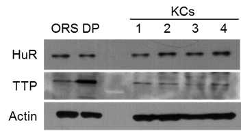 피부세포에서 RNA결합단백질 HuR, TTP의 발현 (ORS;외모근초세포, DP;모유두세포, KCs;각질형성세포)