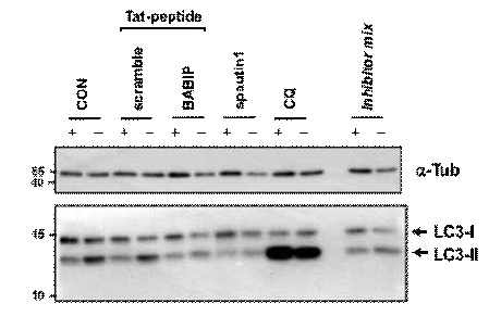 BABIP inhibits cellular autophagy in response to glucose starvation. HEK293 cells were starved with glucose for 4 hours in the presence or absence of a N-terminally cell membrane-penentrating Tat sequence fused BABIP (Beclin1 290-310), in which a peptide with a random sequence in the same amino acid length with BABIP was used as a control (scramble)