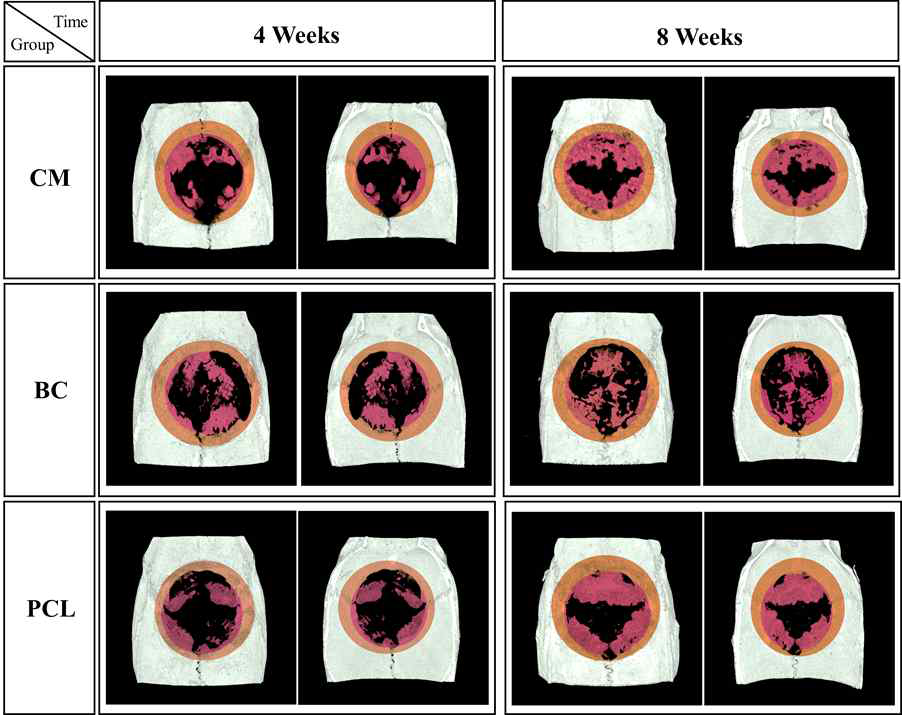 3D reconstruction images of new bone formed in the rat calvarial defects in CM, BC, and PCL. The orange circle area signified the barrier membrane, and the inner pink circle signified the new bone formed in the 8 mm critical size defect