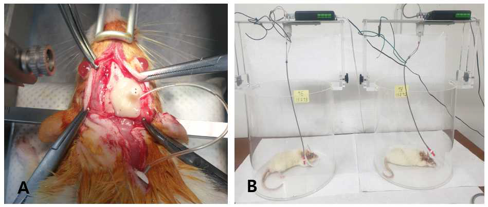 약물을 주입한 위치에서의 뇌파(EEG)상 변화가 있는지 확인하기 위한 수술 및 EEG 측정-(A) bupivacaine이 주입되는 위치와 근접한 해마주변 부위에 EEG 측정 electrode를 삽입하여 수술함. (B) 수술 후 일주일의 안정기를 거친 쥐를 EEG 측정함