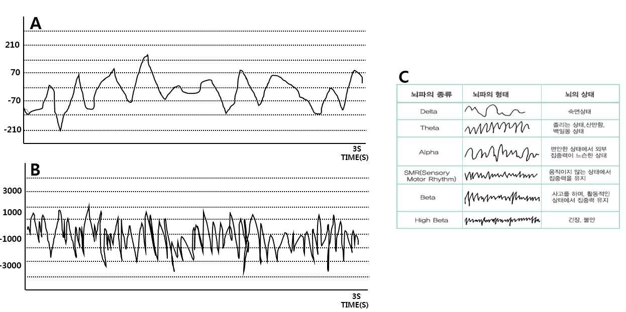 bupivacaine 주입, aCSF 주입한 쥐들의 해마주변 부위에서의 EEG 측정 및 신호결과 (A) bupivacaine을 주입 후 일주일에 측정한 실험동물 뇌파 결과 (B) aCSF를 주입 후 일주일에 측정한 실험동물 뇌파 결과 (C) 뇌파의 형태 비교를 위한 참고자료