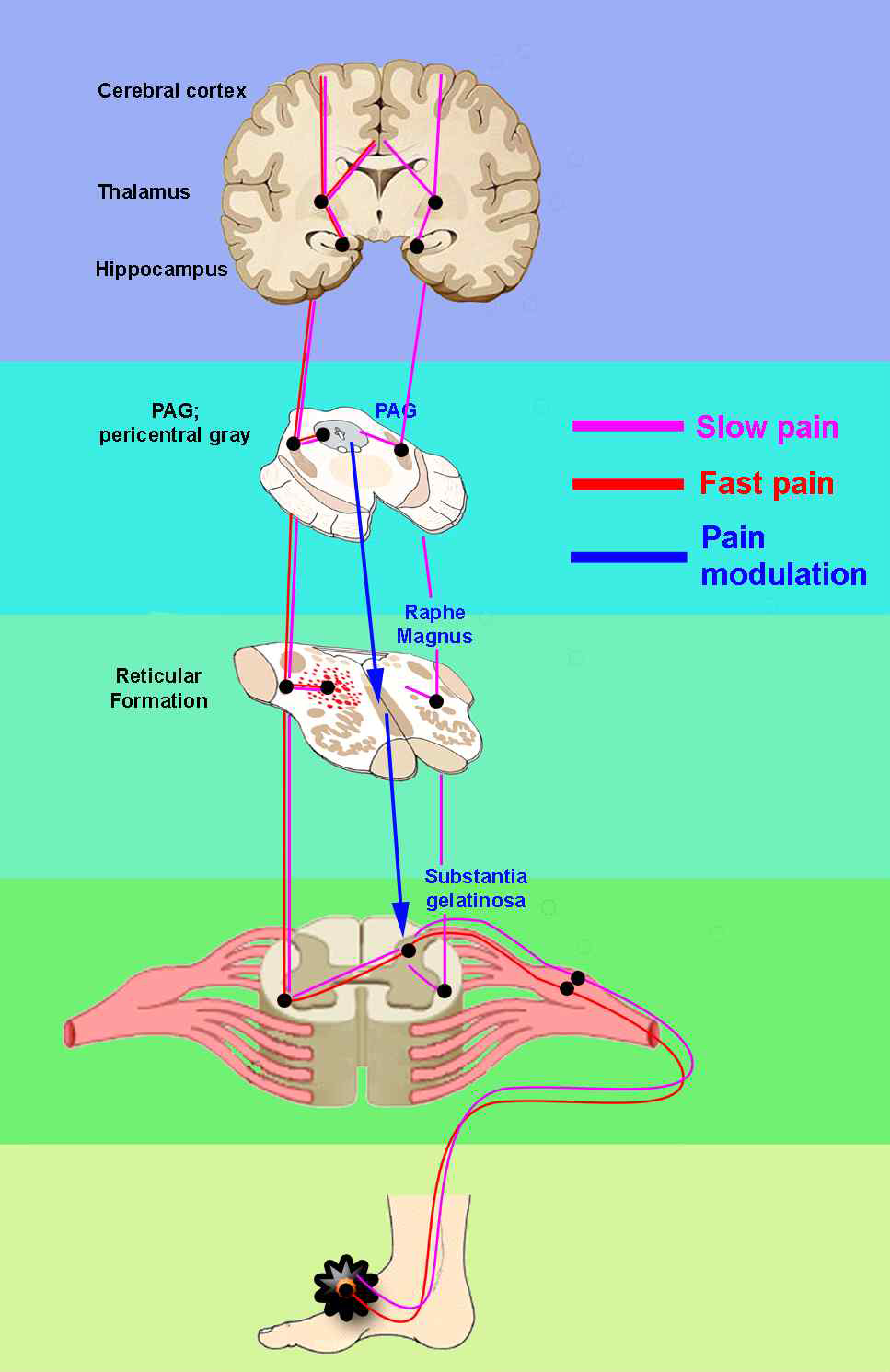 Slow pain 및 fast pain 경로 및 통증조절 모식도. 자세한 내용은 본문 참조