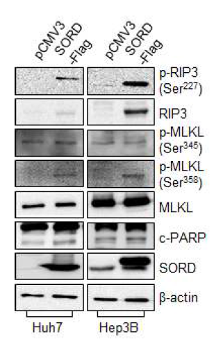 SORD 과발현 된 Huh7, Hep3B 간암세포의 세포사멸 기전 연구