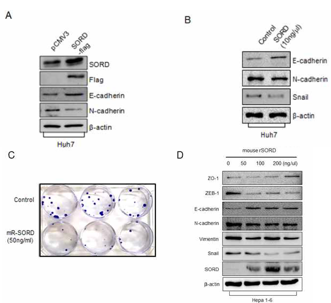 SORD 과발현 세포 및 SORD 재조합단백질 처리에 의한 EMT 관련 단백질 발현
