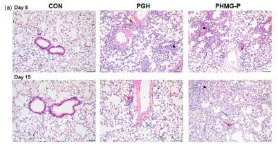 PHMG-P와 PGH를 단회 투여한 마우스 폐의 조직병리학적 변화