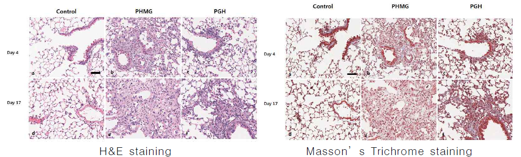 PHMG-P (1.5 mg/kg)와 PGH (3 mg/kg)를 단회 비강 투여한 마우스 폐의 조직병리학적 분석