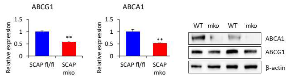 대식세포에서의 ABCG1과 ABCA1의 발현 변화
