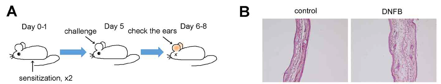 (A) 첫 이틀 동안 DNFB로 sensitization, 5일째 challenge함. (B) challenge 1-3일 후 귀가 붓고 피부조직에 염증세포의 침윤이 보인다