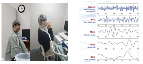 뇌파 측정 및 뇌파 그래프
