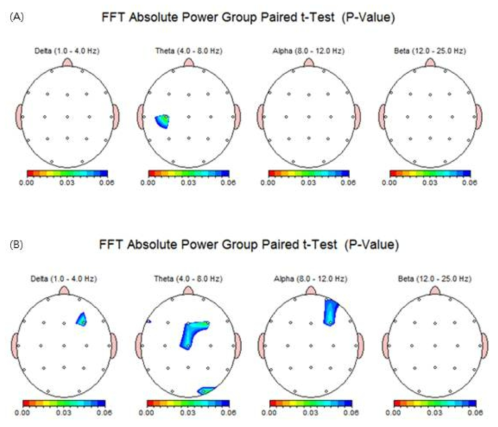 발아밀 음료의 뇌파측정 결과; 알곡 형태의 차가운 음료 (a), 티백 형태의 뜨거운 음료 (b)