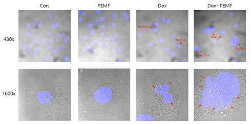 DOX 단독처리군에 비해 PEMF 병용처리 시 핵 분엽이 더욱 증가함을 보여주는 결과