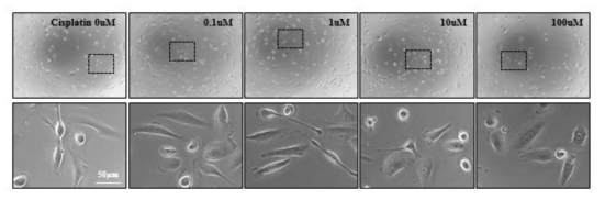 NCI-H28 세포주의 cisplatin 처리 24시간 후의 변화. cisplatin에 내성을 보여 LD 50을 찾지 못함