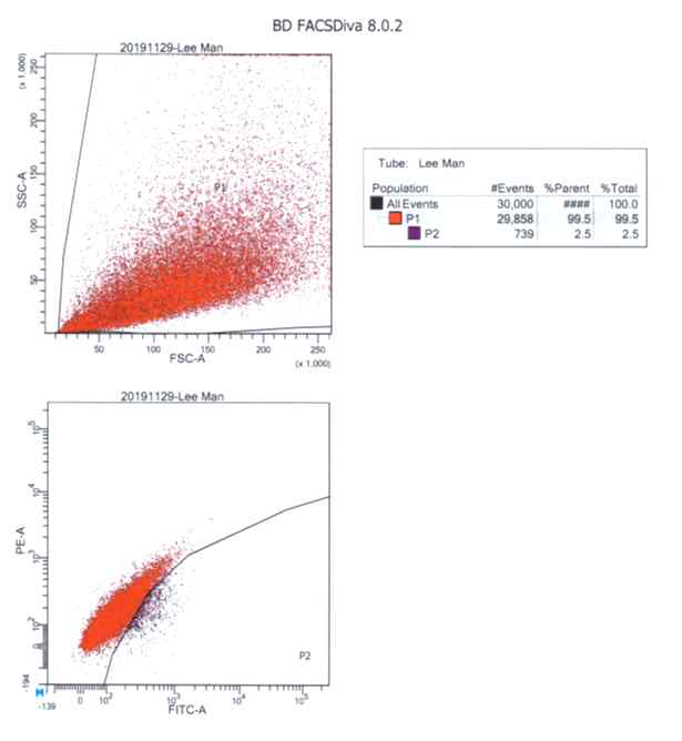 FACS data for Mesothelioma (WT1 marker) 전체의 2.5%(P2 fraction)만이 중피종 세포임