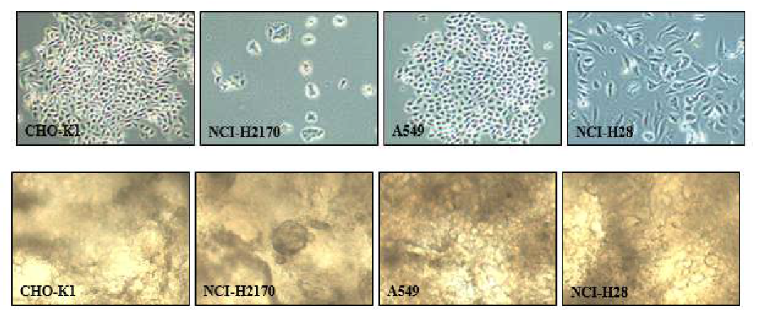상단: 2D로 배양한 동일세포주의 세포형태. 하단: 각 해당 세포주의 3D 세포주